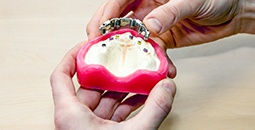 Model of All-on-4 denture