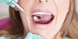 Woman receives dental examination
